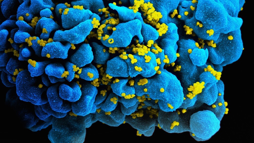 HIV_H9_T-cell-1024x576.jpg