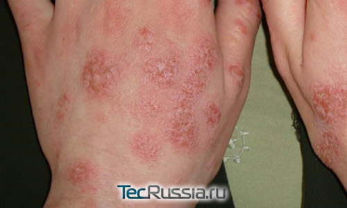 1401195272_lichen-14.jpg